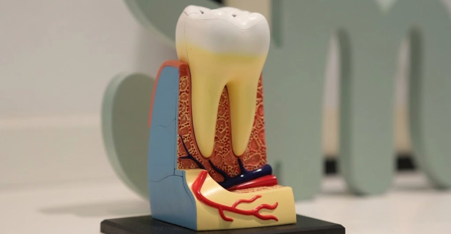 Dental Resorption